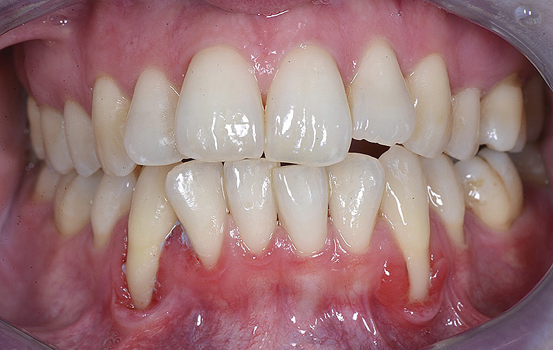 73644 170131_servizi