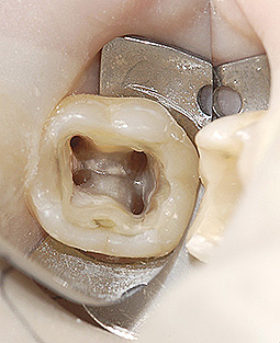 endodonzia 5