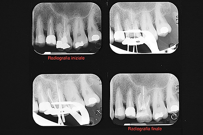 endodonzia 5