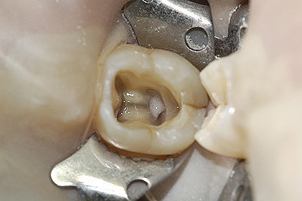endodonzia 5